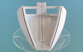 Jegliches &uuml;berfl&uuml;ssige Material wurde entfernt